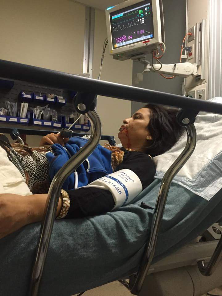 Director Dinesh Dc meets with accident at America Texas- thecinematimes.com